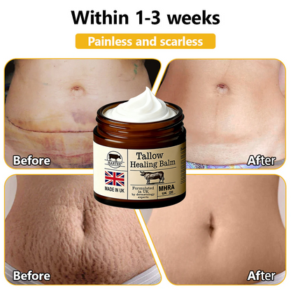 HARTEE® Tallow Healing Balm🐄（GMP Facility • FDA-Registered • Dermatologist Tested👨‍⚕️）Soothe eczema, psoriasis & rosacea—without steroids.🐄