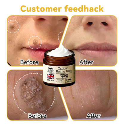 HARTEE® Tallow Healing Balm🐄（GMP Facility • FDA-Registered • Dermatologist Tested👨‍⚕️）Soothe eczema, psoriasis & rosacea—without steroids.🐄