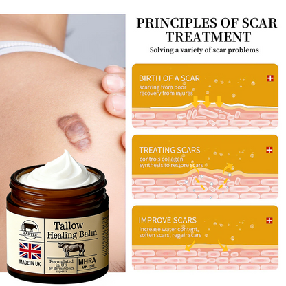 HARTEE® Tallow Healing Balm🐄（GMP Facility • FDA-Registered • Dermatologist Tested👨‍⚕️）Soothe eczema, psoriasis & rosacea—without steroids.🐄