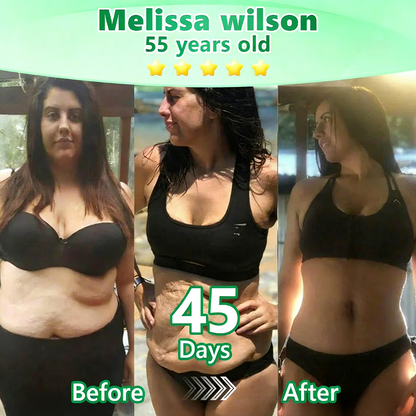 【🇬🇧𝐿𝑎𝑠𝑡 𝐷𝑎𝑦 𝑃𝑟𝑜𝑚𝑜𝑡𝑖𝑜𝑛 70% 𝑂𝐹𝐹】|𝙋𝙪𝙧𝙚𝙡𝙪𝙭𝙤® 𝑴𝒐𝒓𝒊𝒏𝒈𝒂 & 𝑩𝒆𝒓𝒃𝒆𝒓𝒊𝒏𝒆 *NAD+| Slimming & Firming 2-in-1 Nano Microneedle Patch|𝘉𝘢𝘤𝘬𝘦𝘥 𝘣𝘺 𝘴𝘤𝘪𝘦𝘯𝘤𝘦 | 10-𝗂𝗇-𝟣 𝖿𝗈𝗋𝗆𝗎𝗅𝖺 | 𝑅𝑒𝑠𝑢𝑙𝑡𝑠 𝑖𝑛 7 𝑑𝑎𝑦𝑠 ⏳