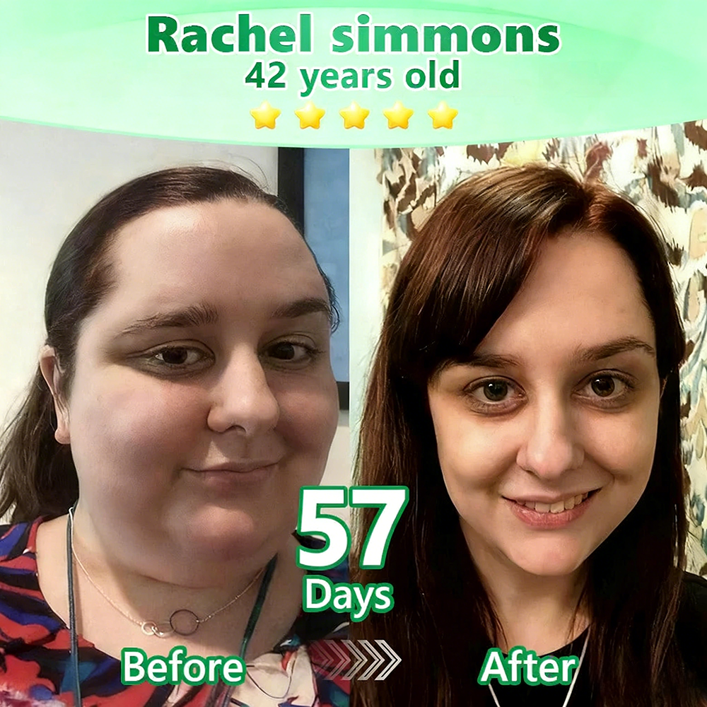 【🇬🇧𝐿𝑎𝑠𝑡 𝐷𝑎𝑦 𝑃𝑟𝑜𝑚𝑜𝑡𝑖𝑜𝑛 70% 𝑂𝐹𝐹】|𝙋𝙪𝙧𝙚𝙡𝙪𝙭𝙤® 𝑴𝒐𝒓𝒊𝒏𝒈𝒂 & 𝑩𝒆𝒓𝒃𝒆𝒓𝒊𝒏𝒆 *NAD+| Slimming & Firming 2-in-1 Nano Microneedle Patch|𝘉𝘢𝘤𝘬𝘦𝘥 𝘣𝘺 𝘴𝘤𝘪𝘦𝘯𝘤𝘦 | 10-𝗂𝗇-𝟣 𝖿𝗈𝗋𝗆𝗎𝗅𝖺 | 𝑅𝑒𝑠𝑢𝑙𝑡𝑠 𝑖𝑛 7 𝑑𝑎𝑦𝑠 ⏳