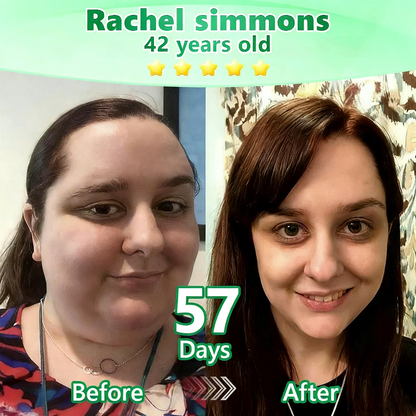 【🇬🇧𝐿𝑎𝑠𝑡 𝐷𝑎𝑦 𝑃𝑟𝑜𝑚𝑜𝑡𝑖𝑜𝑛 70% 𝑂𝐹𝐹】|𝙋𝙪𝙧𝙚𝙡𝙪𝙭𝙤® 𝑴𝒐𝒓𝒊𝒏𝒈𝒂 & 𝑩𝒆𝒓𝒃𝒆𝒓𝒊𝒏𝒆 *NAD+| Slimming & Firming 2-in-1 Nano Microneedle Patch|𝘉𝘢𝘤𝘬𝘦𝘥 𝘣𝘺 𝘴𝘤𝘪𝘦𝘯𝘤𝘦 | 10-𝗂𝗇-𝟣 𝖿𝗈𝗋𝗆𝗎𝗅𝖺 | 𝑅𝑒𝑠𝑢𝑙𝑡𝑠 𝑖𝑛 7 𝑑𝑎𝑦𝑠 ⏳